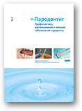Parodontitis - Erkrankungen des Zahnhalteapparates vermeiden, erkennen, behandeln (Russisch)
