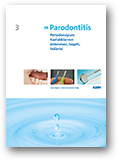 Parodontitis - Erkrankungen des Zahnhalteapparates vermeiden, erkennen, behandeln (Türkisch)